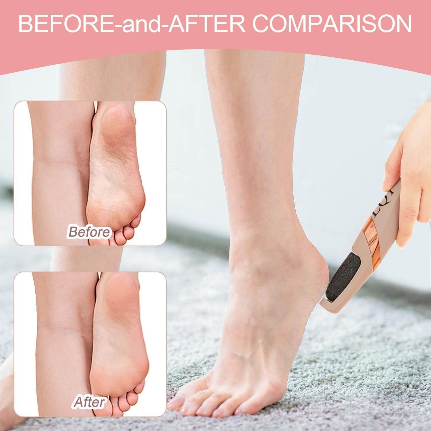 Electric Foot Callus Remover - Trendhub Pakistan